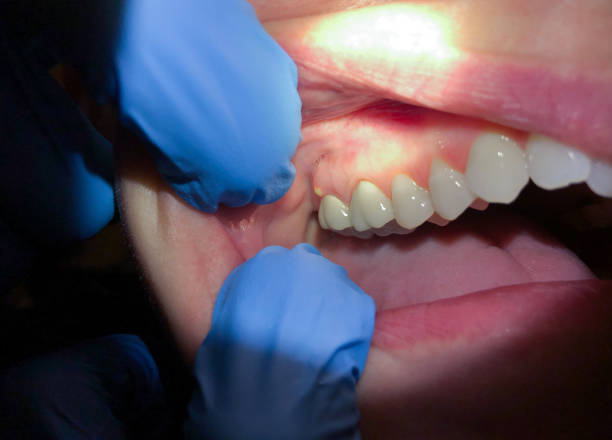 Best Emergency Dental Surgery in Wiggins, MS