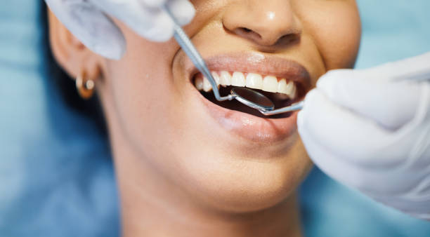 Best Emergency Tooth Extraction in Wiggins, MS