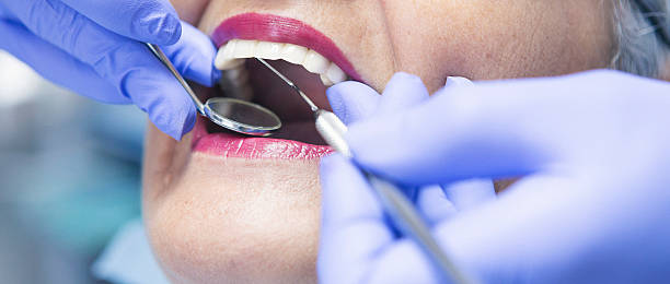 Best Emergency Treatment for Toothache in Wiggins, MS